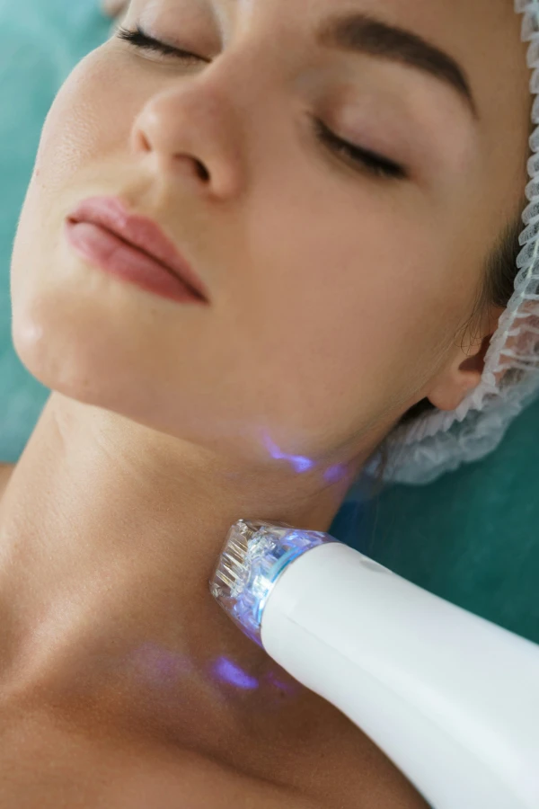 RF Microneedling